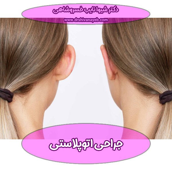 جراحی اتوپلاستی