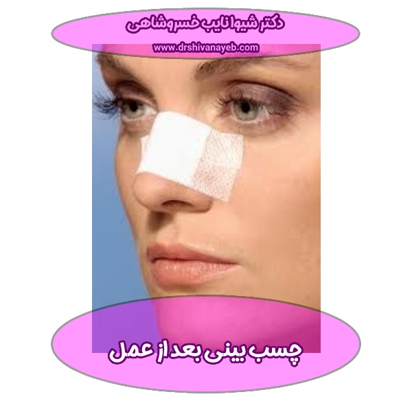 چسب بینی بعد از عمل