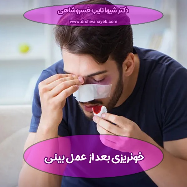 خونریزی بعد از عمل بینی