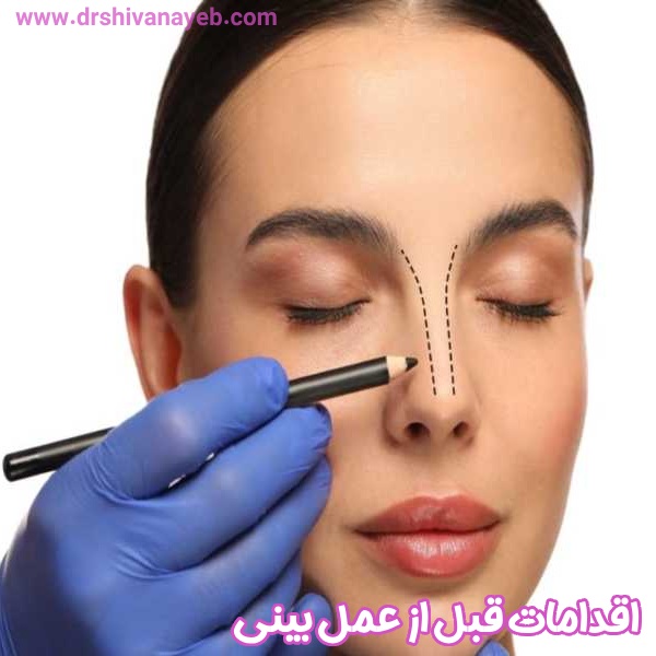 اقدامات قبل از عمل بینی