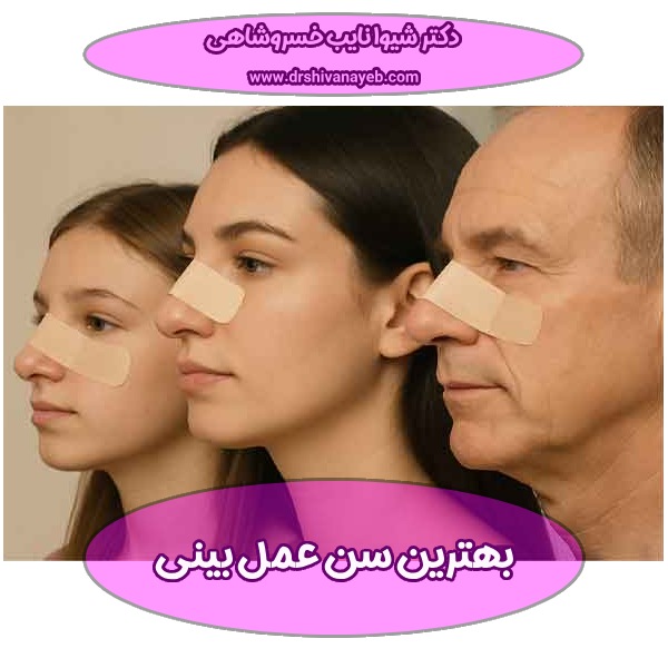 بهترین سن عمل بینی