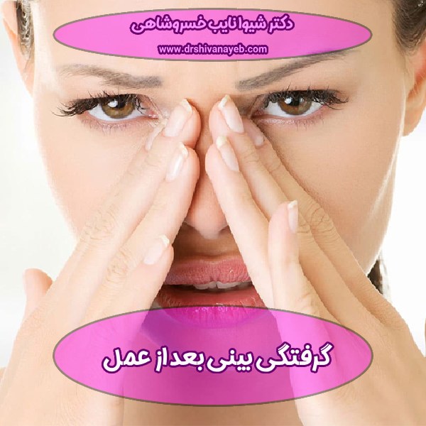 گرفتگی بینی بعد از عمل
