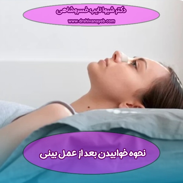 نحوه خوابیدن بعد از عمل بینی