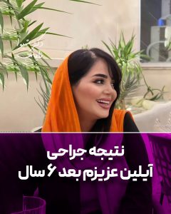 جراحی بینی در تبریز 