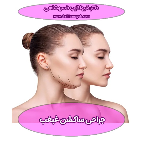 ساکشن غبغب