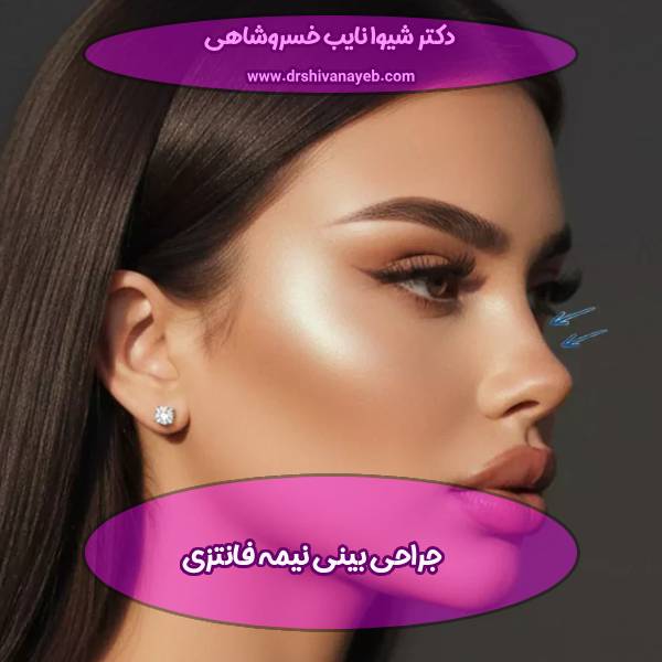 جراحی بینی نیمه فانتزی